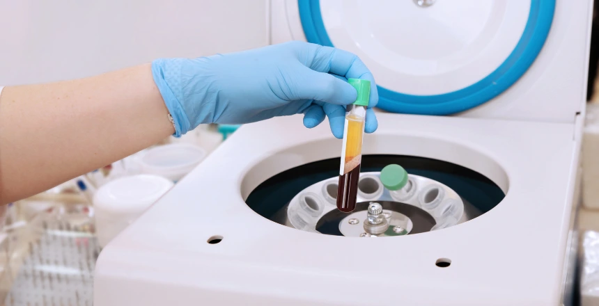 A centrifuge spins a blood sample to separate platelet-rich plasma for advanced skin treatments.